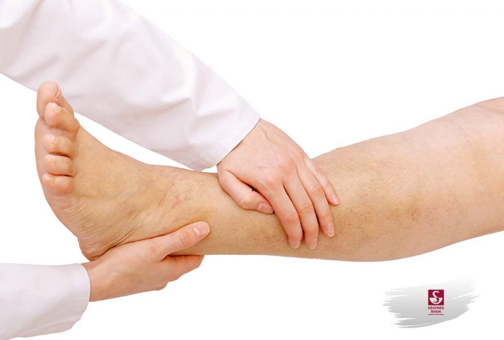 sabes que es un edema