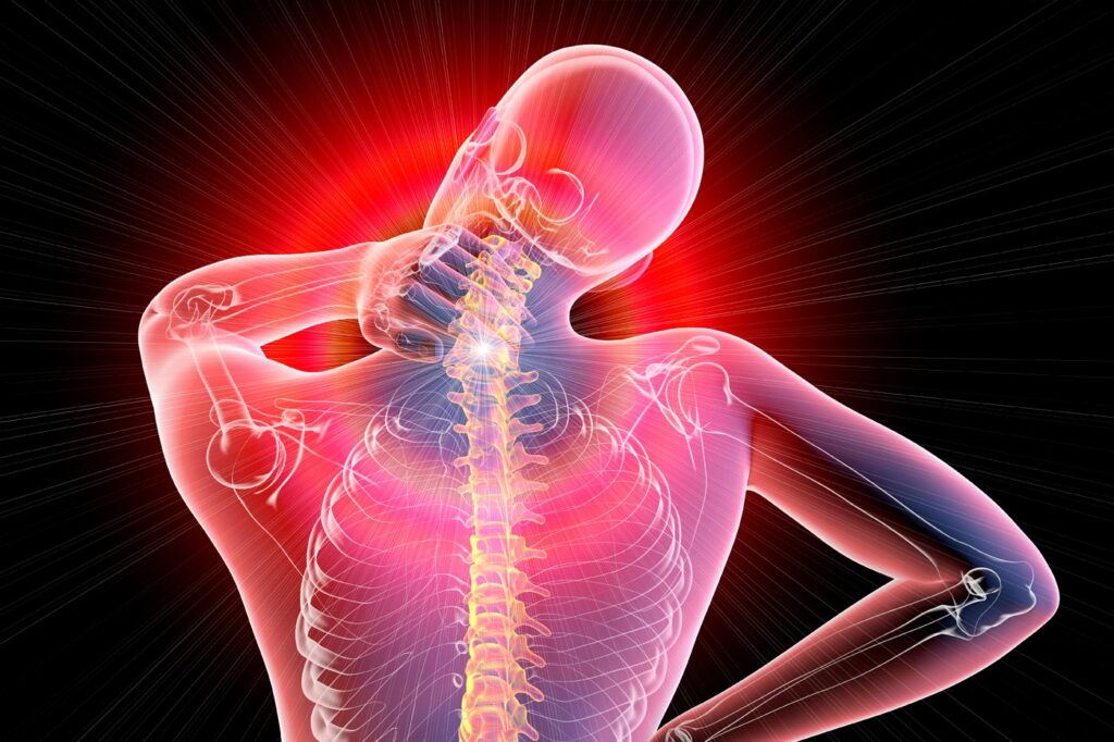 Radiografía Fibromialgia