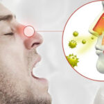Hombre con alergia y congestión nasal
