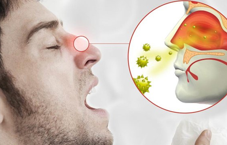 Hombre con alergia y congestión nasal